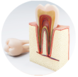 root canal